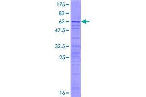 AP3S2 Protein (AA 1-193) (GST tag)