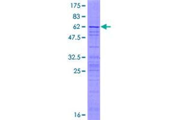 AP3S2 Protein (AA 1-193) (GST tag)