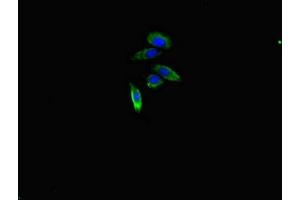 Immunofluorescent analysis of HepG2 cells using ABIN7167919 at dilution of 1:100 and Alexa Fluor 488-congugated AffiniPure Goat Anti-Rabbit IgG(H+L) (ARHGAP1 Antikörper  (AA 542-744))