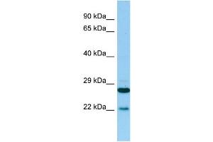 WB Suggested Anti-PTGES2 Antibody Titration: 1.