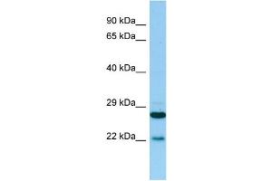 WB Suggested Anti-PTGES2 Antibody Titration: 1. (PTGES2 Antikörper  (N-Term))