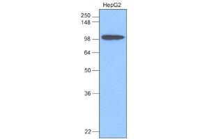 Western Blotting (WB) image for anti-Hexokinase 1 (HK1) antibody (ABIN361062) (Hexokinase 1 Antikörper)