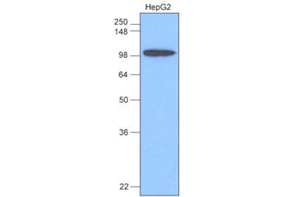 Hexokinase Antikörper  (AA 1-917)