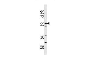 Western blot analysis of CPN2 antibody (N-term) (ABIN391524 and ABIN2841483) in jurkat cell line lysates (35 μg/lane). (CPN2 Antikörper  (N-Term))