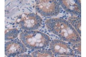 DAB staining on IHC-P; Samples: Rat Intestine Tissue (IL-4 Antikörper  (AA 61-111))