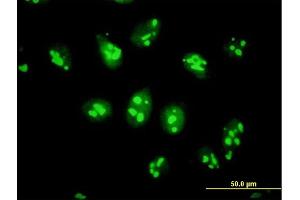 Immunofluorescence of purified MaxPab antibody to PES1 on HeLa cell. (PES1 Antikörper  (AA 1-588))