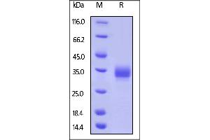 SDS-PAGE (SDS) image for Leukocyte-Associated Immunoglobulin-Like Receptor 1 (LAIR1) (AA 22-163) protein (His tag,AVI tag,Biotin) (ABIN5674600)