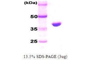 Figure annotation denotes ug of protein loaded and % gel used. (DnaK (AA 1-384), (N-Term) Protein)