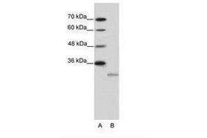 Image no. 1 for anti-Eukaryotic Translation Initiation Factor 4E Family Member 2 (EIF4E2) (N-Term) antibody (ABIN202116) (EIF4E2 Antikörper  (N-Term))