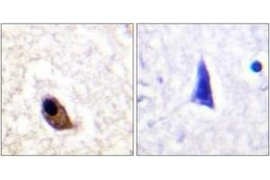 Immunohistochemistry analysis of paraffin-embedded human brain, using NMDAR2A/B (Phospho-Tyr1246/1252) Antibody. (NMDAR2A + 2B Antikörper  (pTyr1246))