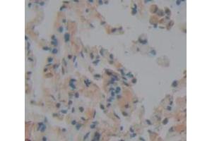 IHC-P analysis of Human Tissue, with DAB staining. (Peroxidasin Antikörper  (AA 76-260))