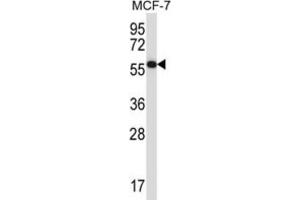 Western Blotting (WB) image for anti-Mitogen-Activated Protein Kinase Associated Protein 1 (MAPKAP1) antibody (ABIN2997754)