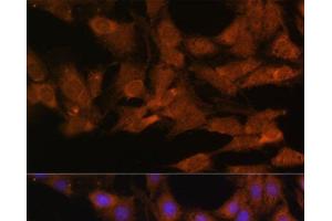 Immunofluorescence analysis of C6 cells using DDX3X Polyclonal Antibody at dilution of 1:100. (DDX3X Antikörper)
