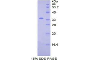 SDS-PAGE analysis of Human CDK4 Protein.