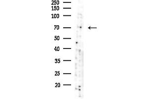 Western blot analysis of lysates from Hela cells(starvation,24h treatment), using SOX5 Antibody at 1/1000 dilution.