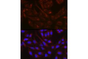 Immunofluorescence analysis of U-2 OS cells using NSF Rabbit pAb (ABIN6130571, ABIN6144871, ABIN6144872 and ABIN6214029) at dilution of 1:100 (40x lens). (NSF Antikörper  (AA 1-250))