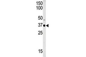 Western Blotting (WB) image for anti-SET Domain Containing 8 Pseudogene 1 (SETD8P1) antibody (ABIN2996452) (SET7 Antikörper)