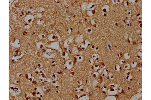 IHC image of ABIN7142212 diluted at 1:100 and staining in paraffin-embedded human brain tissue performed on a Leica BondTM system. (PSMD4/ASF Antikörper  (Regulatory Subunit 4))