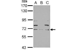 WB Image Sample (30 ug of whole cell lysate) A: PC-3 B: U87-MG C: SK-N-SH 7. (NEFL Antikörper)