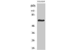 Western Blotting (WB) image for anti-Ribosomal Protein S6 Kinase, 70kDa, Polypeptide 1 (RPS6KB1) (Internal Region) antibody (ABIN3186301) (RPS6KB1 Antikörper  (Internal Region))