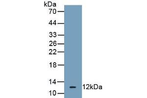 Detection of Recombinant HSPA5, Human using Monoclonal Antibody to Heat Shock 70 kDa Protein 5 (HSPA5)