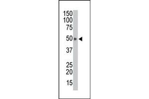 Image no. 1 for anti-HtrA Serine Peptidase 1 (HTRA1) (AA 389-419), (C-Term) antibody (ABIN356844) (HTRA1 Antikörper  (C-Term))