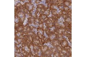 Immunohistochemical staining of human pancreas with ST7L polyclonal antibody  shows moderate cytoplasmic positivity in exocrine pancreas.