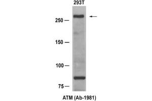 Image no. 1 for anti-Ataxia Telangiectasia Mutated (ATM) (Ser1981) antibody (ABIN319313) (ATM Antikörper  (Ser1981))