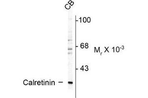 Image no. 1 for anti-Calbindin 2 (CALB2) antibody (ABIN372593) (Calretinin Antikörper)