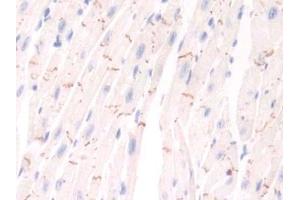 Detection of PIM1 in Mouse Cardiac Muscle Tissue using Polyclonal Antibody to Pim-1 Oncogene (PIM1) (PIM1 Antikörper  (AA 122-261))