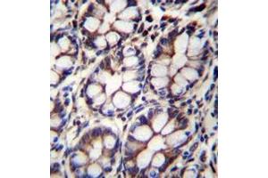 Immunohistochemistry (Paraffin-embedded Sections) (IHC (p)) image for anti-IQ Motif Containing with AAA Domain 1 (IQCA1) (AA 791-822), (C-Term) antibody (ABIN952937)