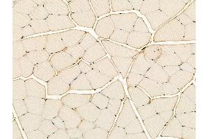 ABIN7094430 and ABIN7098478 at 1/100 staining Rat muscle tissue by IHC-P.