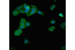 Immunofluorescent analysis of HepG2 cells using ABIN7143048 at dilution of 1:100 and Alexa Fluor 488-congugated AffiniPure Goat Anti-Rabbit IgG(H+L) (IPP Antikörper  (AA 444-515))