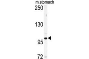 Western Blotting (WB) image for anti-EPH Receptor A6 (Epha6) antibody (ABIN3003335) (EPH Receptor A6 Antikörper)