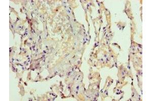 Immunohistochemistry of paraffin-embedded human lung tissue using ABIN7167072 at dilution of 1:100