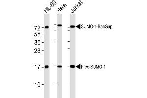All lanes : Anti-SUMO1 Antibody at 1:4000 dilution Lane 1: HL-60 whole cell lysates Lane 2: Hela whole cell lysates Lane 3: Jurkat whole cell lysates Lysates/proteins at 20 μg per lane. (SUMO1 Antikörper)