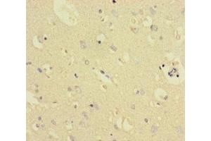 Immunohistochemistry of paraffin-embedded human brain tissue using ABIN7172006 at dilution of 1:100 (TXNDC8 Antikörper  (AA 1-115))