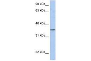 Image no. 1 for anti-Proline Rich 18 (PRR18) (AA 35-84) antibody (ABIN6743875) (Proline Rich 18 Antikörper  (AA 35-84))