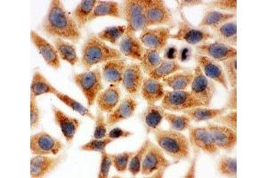 ICC testing of HeLa cells (HSD17B1 Antikörper  (AA 29-43))