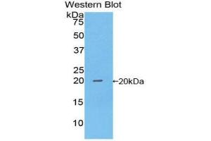 Western Blotting (WB) image for anti-Non-Metastatic Cells 1, Protein (NM23A) Expressed in (NME1) (AA 6-147) antibody (ABIN3202547) (NME1 Antikörper  (AA 6-147))