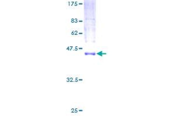 MCFD2 Protein (AA 1-146) (GST tag)