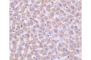 Immunohistochemistry of TIP47 in rat liver tissue with this product at 2 μg/ml. (PLIN3 Antikörper  (N-Term))