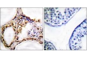 Immunohistochemistry analysis of paraffin-embedded human testis, using RAD52 (Phospho-Tyr104) Antibody. (RAD52 Antikörper  (pTyr104))