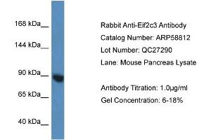 Western Blotting (WB) image for anti-Eukaryotic Translation Initiation Factor 2C3 (EIF2C3) (N-Term) antibody (ABIN2787837) (EIF2C3 Antikörper  (N-Term))