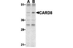 Western Blotting (WB) image for anti-Caspase Recruitment Domain Family, Member 8 (CARD8) (C-Term) antibody (ABIN1030312) (CARD8 Antikörper  (C-Term))