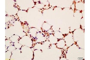 Formalin-fixed and paraffin embedded mouse lung labeled with Anti-LAMP2/CD107B Polyclonal Antibody, Unconjugated  at 1:200 followed by conjugation to the secondary antibody and DAB staining