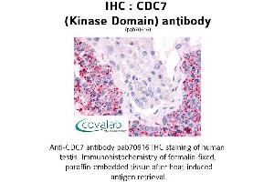 Image no. 1 for anti-Cell Division Cycle 7 (CDC7) antibody (ABIN1732914) (CDC7 Antikörper)