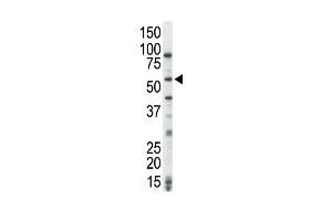 The anti-COT Pab (ABIN392472 and ABIN2842056) is used in Western blot to detect COT in HeLa cell lysate. (MAP3K8 Antikörper  (C-Term))