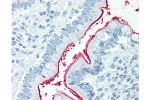 Anti-NPC1L1 antibody IHC staining of human small intestine.