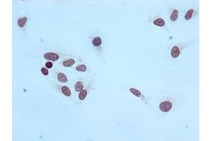 Immunocytochemistry (ICC) image for anti-Histone Cluster 1, H4a (HIST1H4A) (3meLys20) antibody (ABIN7127312)